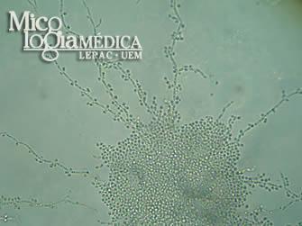 glabrata, C. parapsilosis, C. Krusei, C. guilliermondii, C. famata, C.Kefyr e C. haemulonii, que passaram a ser considerados importantes patôgenos oportunistas.