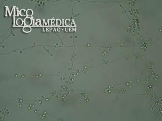 identificação específica da C. tropicalis como um agente etiológico da infecção, como a um aumento do numero de pacientes imunocomprometidos susceptíveis ao ataque de fungos oportunistas.
