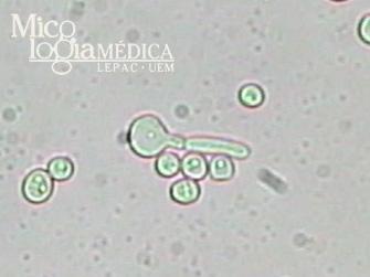 Figura 05- Candida albicans. Fonte: ttp://www.dac.uem.br/micologia/imagens/img_micoses/candida_albicans_tubo_germinativo.