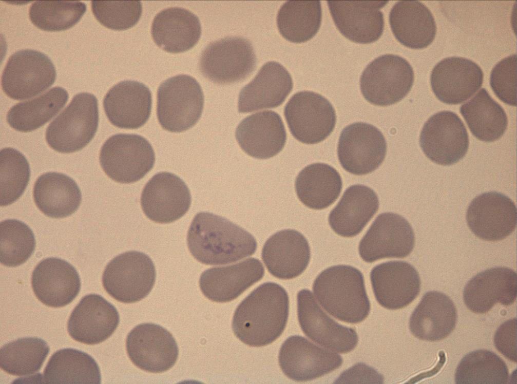 LEUCOPENIA - As causas mais comuns são: doenças virais (FeLV, parvovirose, cinomose), severa infecção bacteriana (toxemia bacteriana,