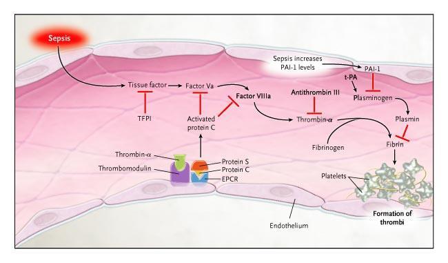 Fisiopatologia da Sepse N Engl