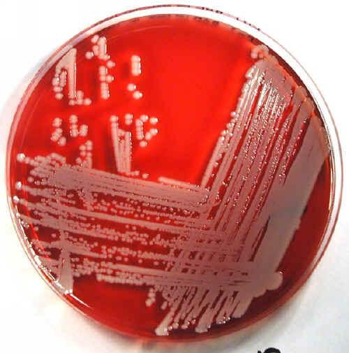 Figura 1: Staphylococcus aureus 3.2.