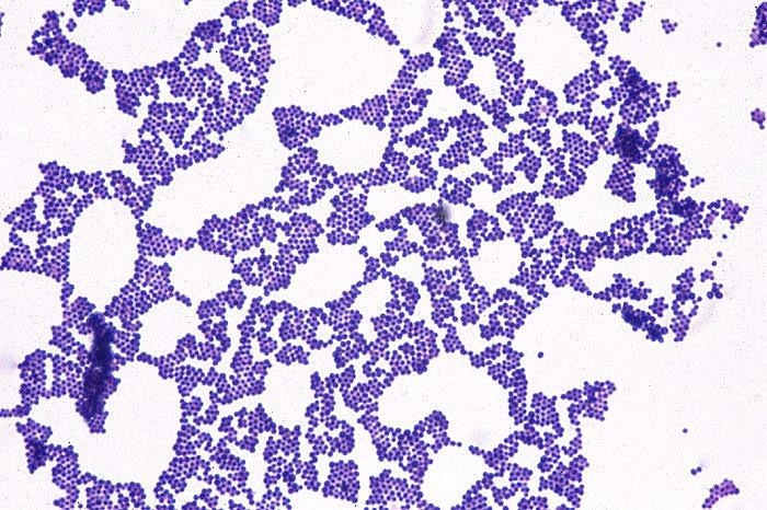 apresentaram na forma de cocos Gram-positivos (azul escuro) foram então avaliadas, quanto aos outros testes. Figura 2: Coloração Gram Coco Gram positivo 3.