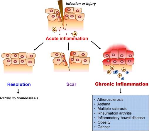 Resoluçao da Inflamaçao RESPOSTA