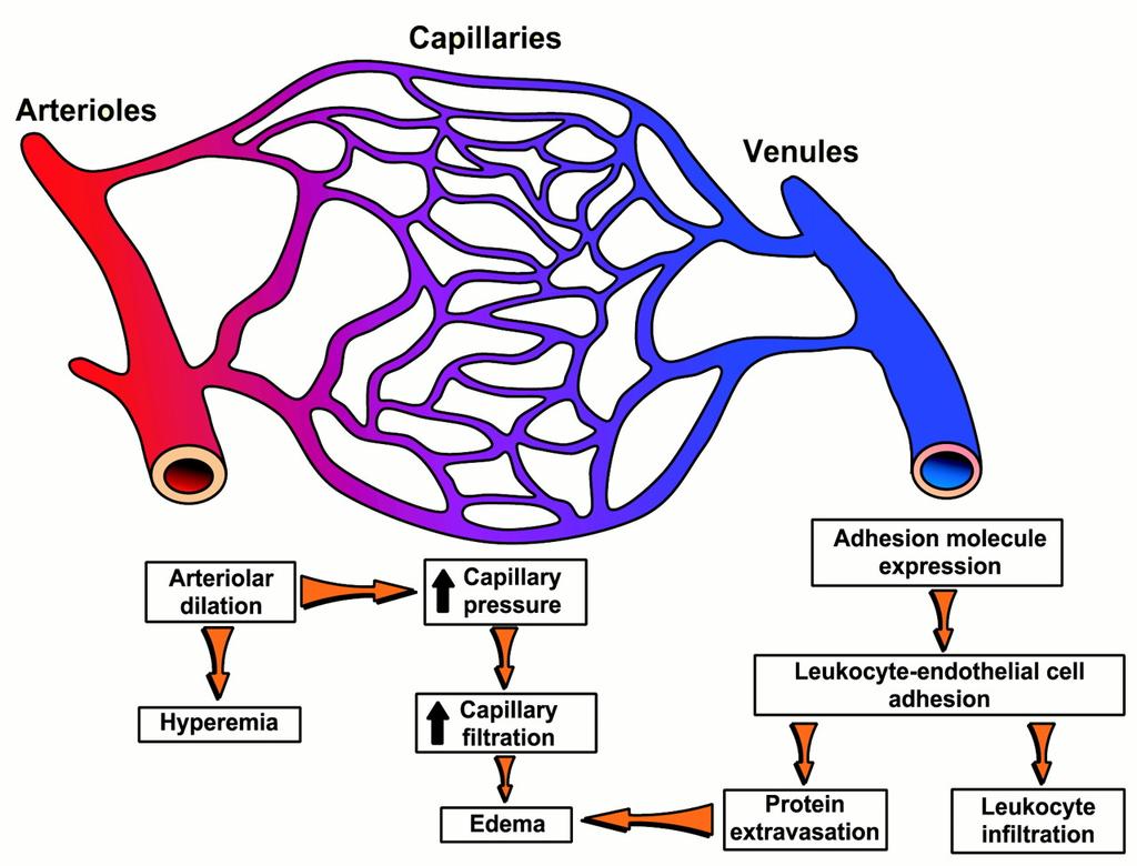 Modificaçao da microcirculaçao 1. Aumento diametro vascular 2. Ativaçao do endotelio 3. Aumento permeabilidade vascular 4.