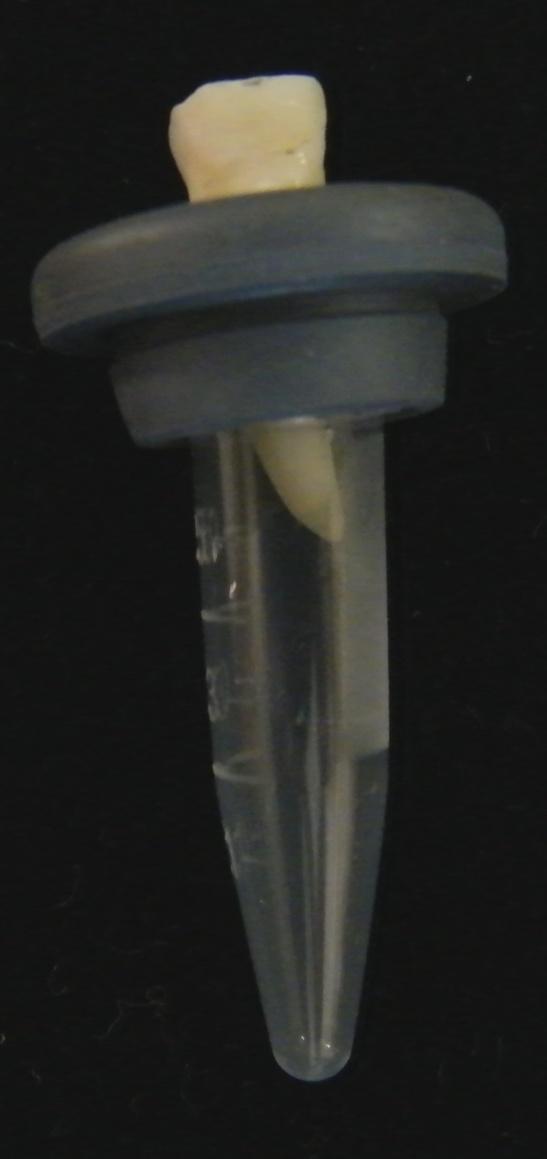 Material e Métodos - 49 - Uma agulha calibre 22G, de 7,5 mm de comprimento (BD, Becton Dickinson Industria Cirúrgica LTDA, Curitiba, PR, Brasil), previamente curvada, foi