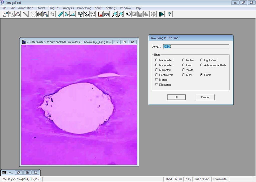 - 56 - Material e Métodos A Figura 6. Tela do software Image Tool com imagem de corte histológico, demonstrando a calibração da medida padrão, 30 pixels equivaleram a 1 mm.