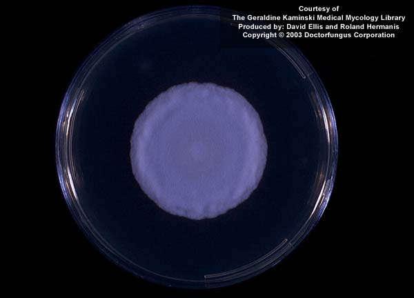 Histoplasma capsulatum Cultivo em ágar Sabouraud Colônias de