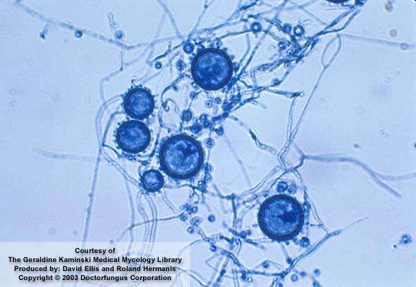 Microcultivo Histoplasma capsulatum a 25 o C Característica