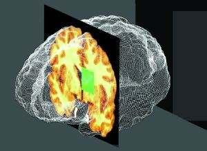 Biomedical Informatics Research Network Imagens cerebrais fornecem informação que