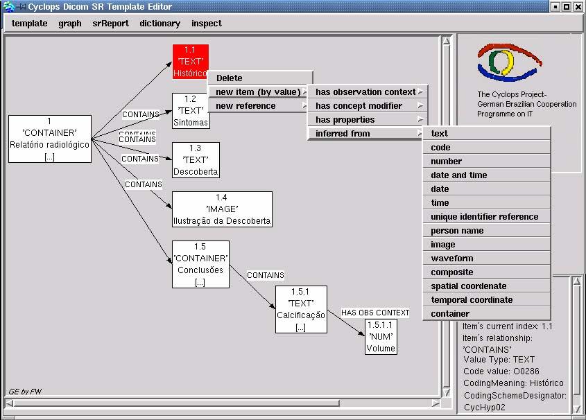 Figura 2: edição de um modelo de laudo DICOM SR utilizando o editor de modelos Editor de laudos Além do editor de estruturas está em fase final de desenvolvimento um editor de conteúdo de laudo.