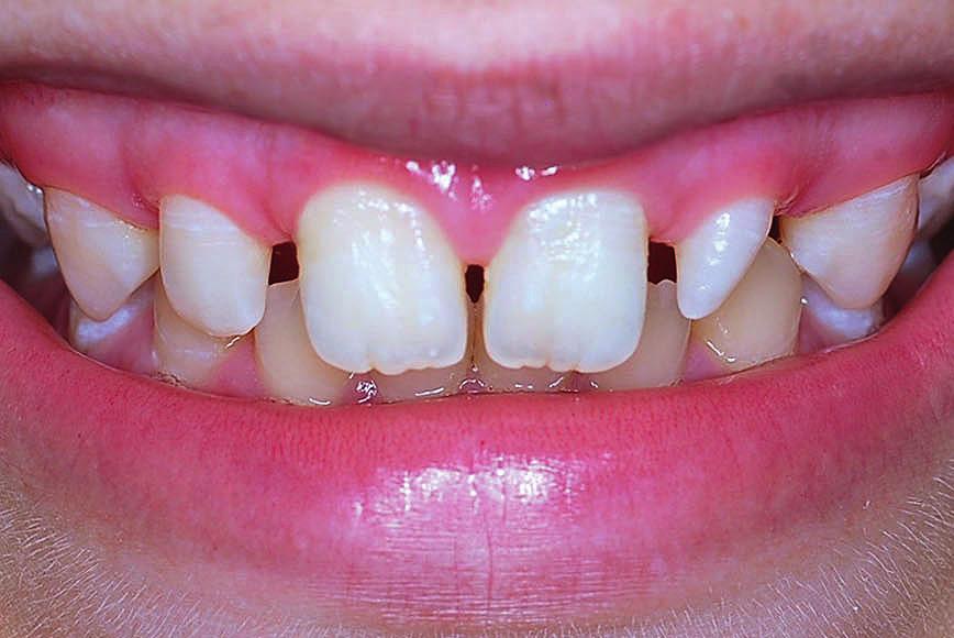 Caso Clínico * Mestranda em Odontologia na Faculdade de Odontologia da