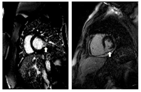 Int J Cardiovasc Sci.