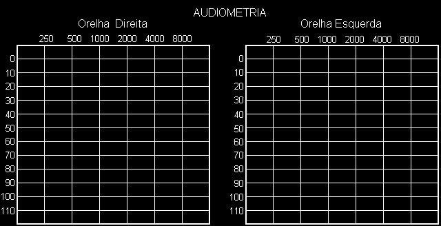 76 APÊNDICE III Protocolo Padrão UNIVERSIDADE FEDERAL DE SANTA MARIA CENTRO DE CIÊNCIAS DA SAÚDE MESTRADO EM DISTÚRBIOS DA COMUNICAÇÃO HUMANA PROTOCOLO PADRÃO Nome: Gênero: ( )M ( )F Data de