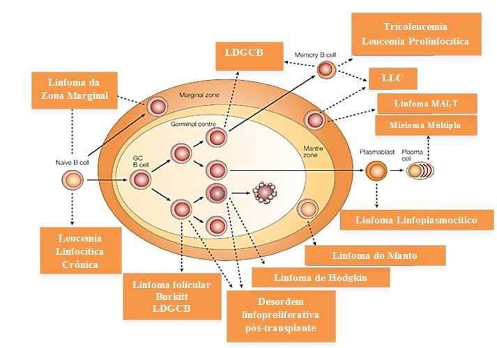 14 1 INTRODUÇÃO As neoplasias linfoproliferativas compõem um vasto espectro de diferentes doenças com morfologia, clínica, características de imunofenótipo e genética distintas.