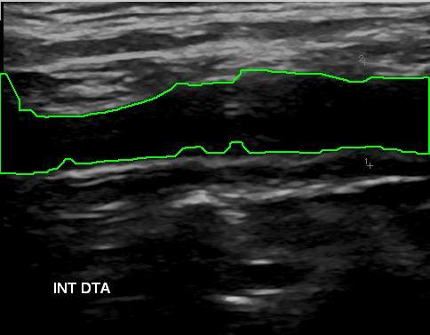 Pereira & Tavares (2011) RecPad 2011, 40-41