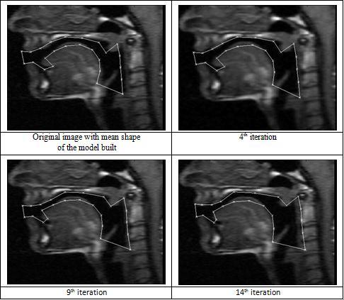 Segmentação Análise do tracto vocal durante a fala partir de imagens de ressonância magnética: modelos ativos de forma Imagem original + modelo médio Segmentação intermédia