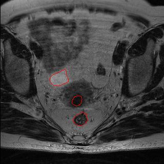 Ma et al. (2011) Computers in Biology and Medicine (submitted) Ma et al. (2011) The Int.