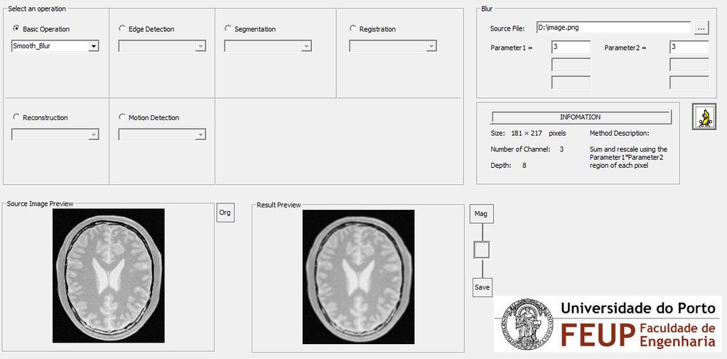 Segmentação Nova plataforma para segmentação de imagens médicas (VC ++,