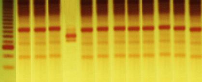 M 1 2 3 4 5 6 7 8 9 10 11 12 La Lg Lb Ll Ls Ln Li FIG. 2. Gel de poliacrilamida 5%, corado com nitrato de prata, mostrando os perfis de restrição obtidos através da técnica de PCR-RFLP utilizando a enzima de restrição HaeIII.