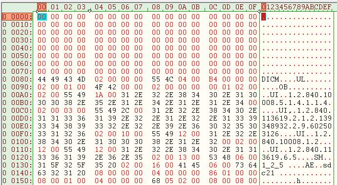 imagens do formato INTERFILE para o FORMATO DICOM.