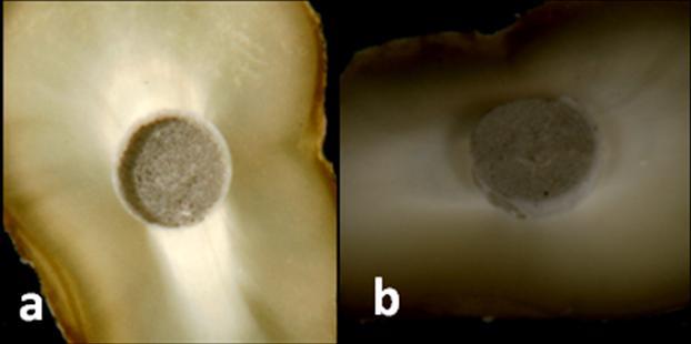 84 Figura 25 - Pela face apical, a imagem sugere falha adesiva entre o pino e o cimento (a). A avaliação da face cervical da mesma fatia evidencia falha do tipo mista (b).