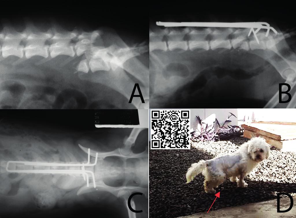 Functional neurologic recovery in two dogs diagnosed with severe luxation of the vertebral column spine revealed an oblique fracture of the L6 vertebral body with a large displacement between L6 and