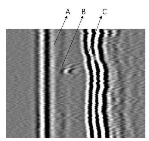 51 possível notar a presença da onda lateral, dos sinais de difração da descontinuidade existente na região da solda e do eco de fundo representada pela onda longitudinal.