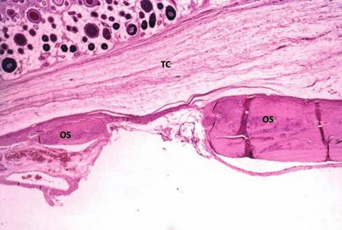 Análise morfométrica da resposta tecidual ao osso bovino misto medular implantado em defeito ósseo na calvária de rato (Vvi) pela relação Vvi = Pi/P, que está expressa em porcentagem.