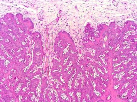 Analisando-se detalhadamente a interação materno-fetal na placenta a termo de jumenta adulta da raça Pêga, constata-se que circundando o tecido fetal encontra-se o epitélio materno apoiado em tecido