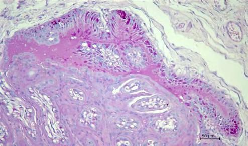 Observar o mesênquima fetal (ME), onde se verificam fibroblastos (fi) e vasos fetais (seta vazada), na região da arcada as células do trofoblato apresentam-se