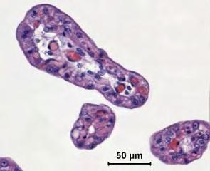 À microscopia de luz observou-se que os vilos apresentavam estroma de tecido conjuntivo, as células trofoblásticas apresentam-se com formato variado, verifica-se epitélio cúbico, pseudoestratificado.