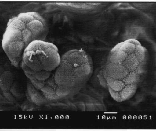 Eletronmicrografias de varredura da membrana córion-alantoide.