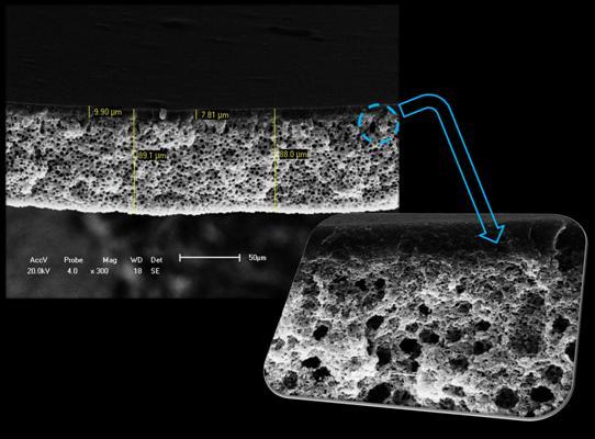 Estas figuras mostram que a pele filtrante apresenta poros muito pequenos ou até mesmo inexistentes, e que a camada porosa apresenta poros interconectados e bem distribuídos.