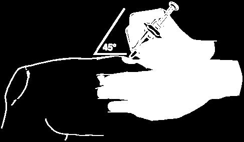 B. Posicione a seringa e injete ORENCIA Com uma mão, segure a seringa pelo corpo entre o dedo indicador e polegar (Figura 5).