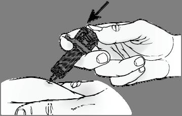 Insira a agulha, com um movimento rápido, num ângulo de 45º na pele presa (Figura 5).