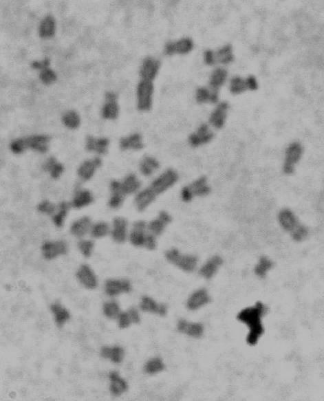 A impregnação pelo nitrato de prata mostrou duas marcações terminais nos braços curtos de dois cromossomos do tipo subtelocêntricos, correspondentes