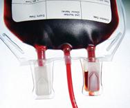Dependência transfusional Considerar sobrecarga de ferro PREVENIR