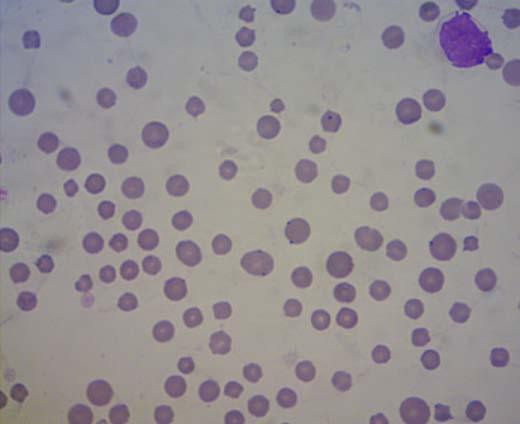 154 Figura 1: Esfregaço sanguíneo evidenciando corpúsculos intraeritrocitários condizentes com Anaplasma marginale (setas). Também se observa anisocitose e policromasia. Aumento de 1000x.