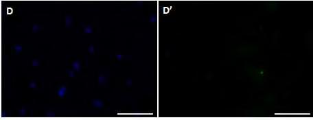 , 2014) Legenda figura 3: Expressão de marcadores de membrana em Ct s de membrana amniótica canina: A, A, A (CD90): A: marcação nuclear com hoechst; A marcação de CD90(mesenquimal) na membrana