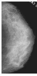 1 para corrigir os níveis de cinza de uma imagem mamográfica digitalizada no scanner óptico de acordo com as características de