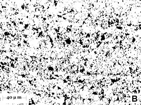 resultado da identificação das áreas ocupadas pela austenita retida após aplicação do threshold através do software ImageJ.