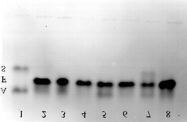 Diagnóstico neonatal da hemoglobina S 2:1, respectivamente, foi aplicado sobre uma lâmina contendo ágar-gel (Bacto-agar-Difco) a 1% em tampão fosfato 6,2.