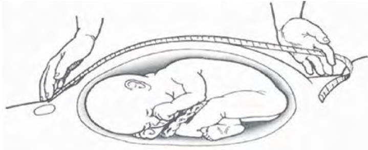 semana, o fundo do útero encontra-se na altura da cicatriz umbilical; - A partir da 20a semana, existe relação direta entre as semanas da gestação e a medida da altura uterina.