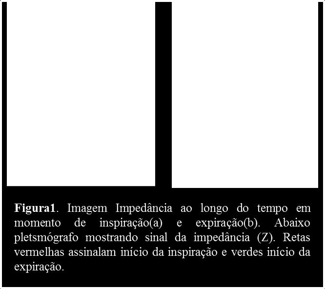 Durante aquisição dos dados, imagens eram obtidas em tempo real para ajudar na execução dos experimentos. Entretanto, apenas os dados de voltagem foram armazenados para posterior análise "off-line".