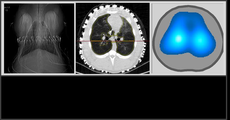 19 Através de outro programa de análise de imagens 41 foram gerados histogramas compostos de distribuição de densidades radiológicas do parênquima pulmonar, combinando todos os