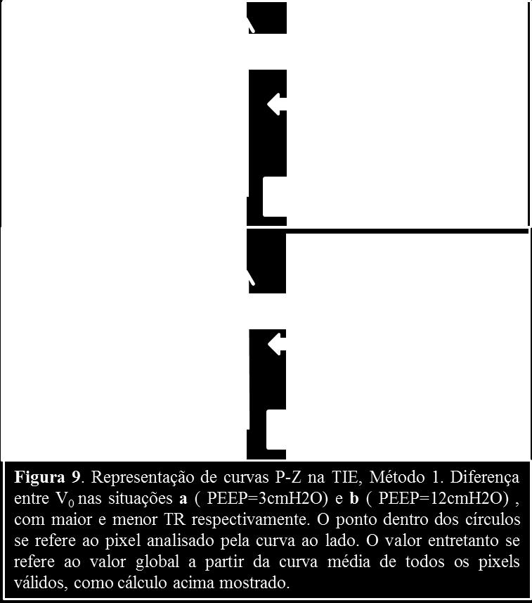 Abaixo apresentamos a representação do Método 1, em 2 situações de PEEP diferentes