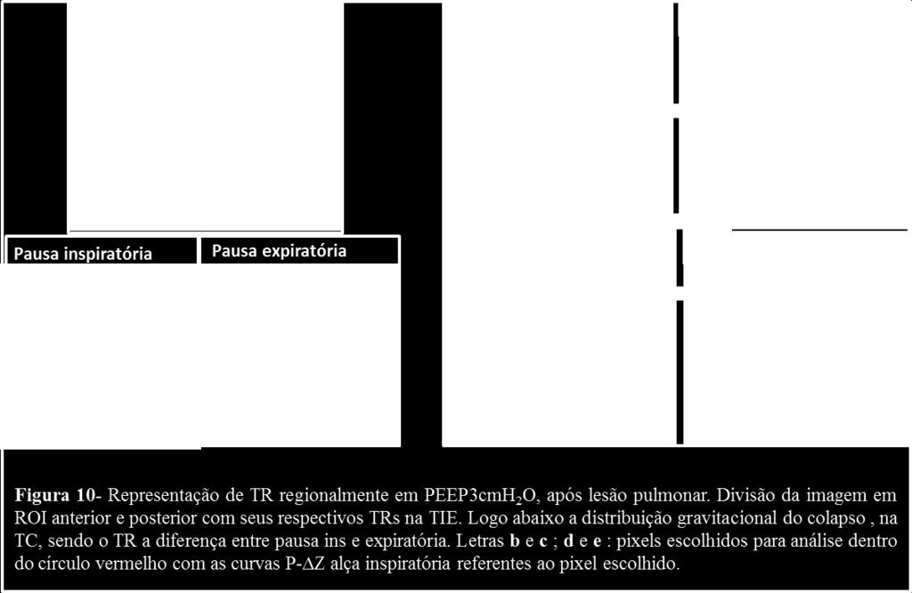 3 Cálculo de TR Método2 Estudos realizados recentemente por Putensen et al 45,46, utilizaram um diferente método para cálculo da abertura e fechamento alveolar cíclico, puramente baseado em dados de