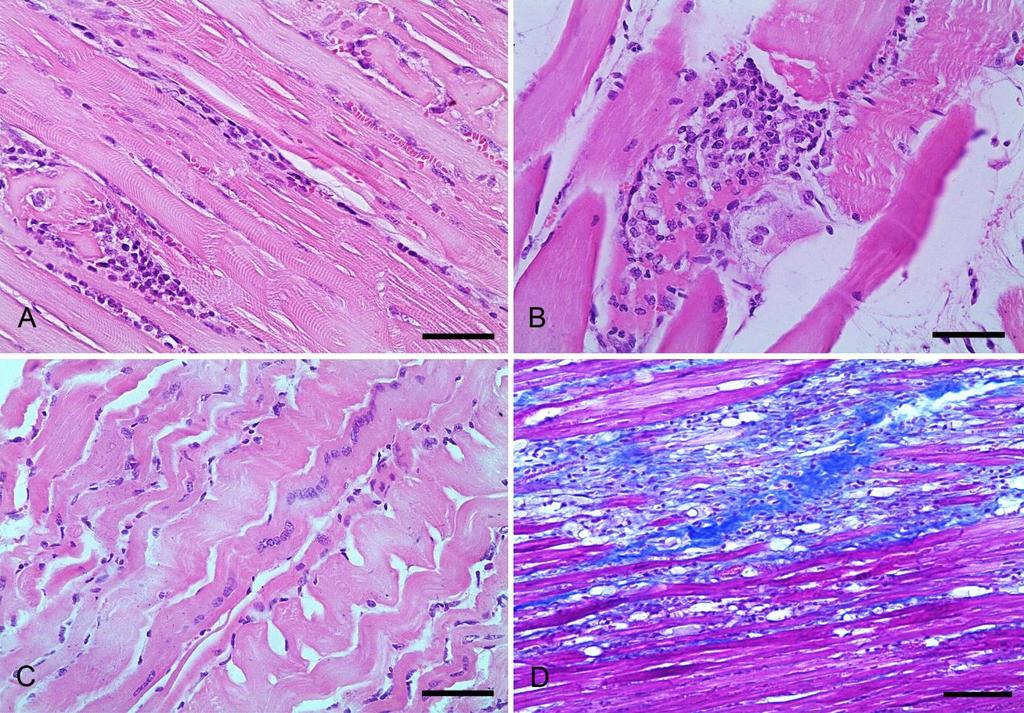 ISSN: 1983-0777 30 Figura-1. Aspectos histopatológicos de lesões musculares em ovinos intoxicados por antibiótico ionóforo.