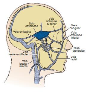 32 8 TROMBOSE SÉPTICA DO SEIO CAVERNOSO A trombose séptica do seio cavernoso (TSSC) é uma complicação encefálica decorrente de infecções faciais ou cranianas como sinusites, otites, infecções
